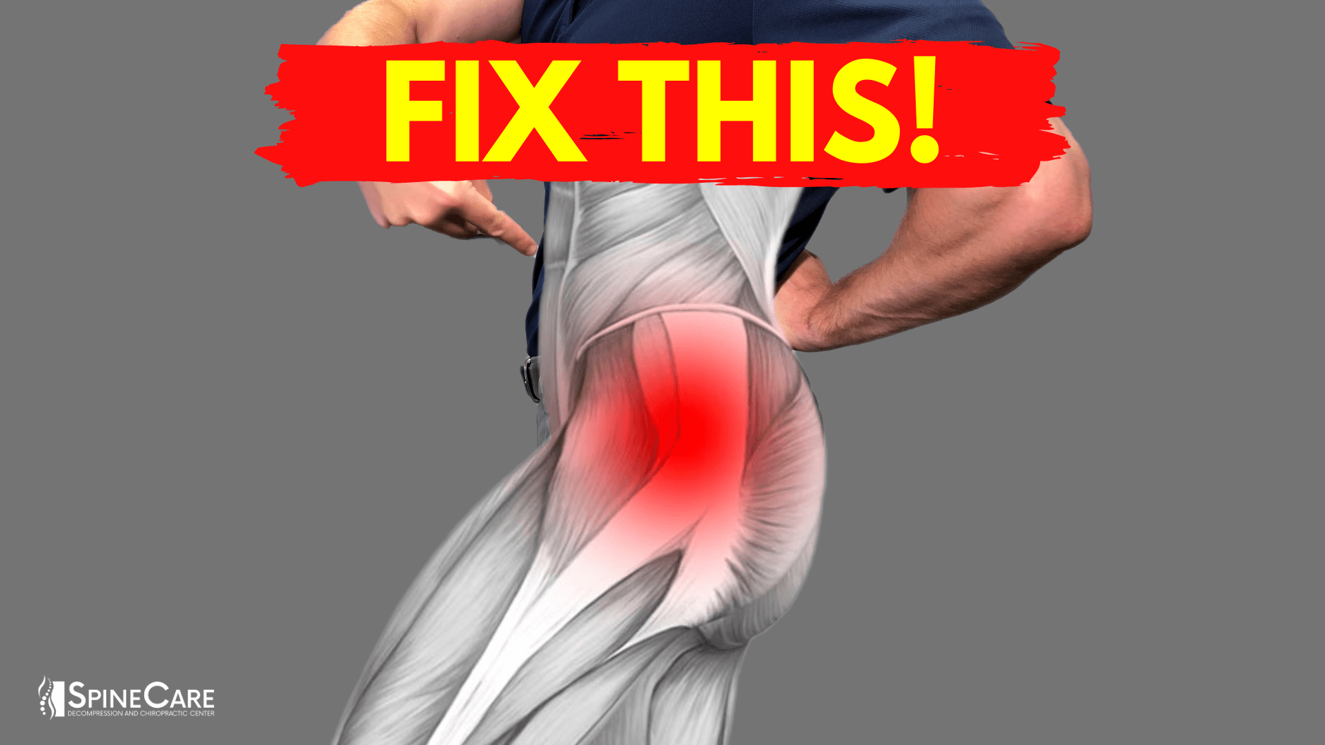 How to Get Rid of Hip Pain for Good