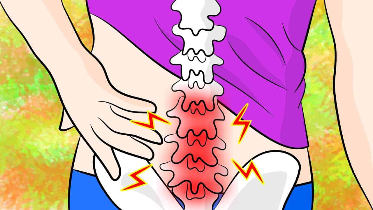 How to Get Rid of Lower Back Rheumatoid Arthritis FAST ...