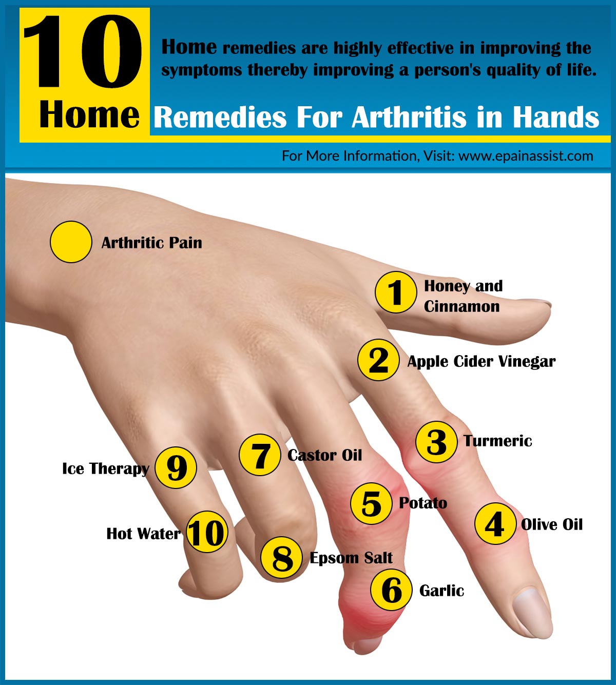 How To Help Rheumatoid Arthritis In Hands