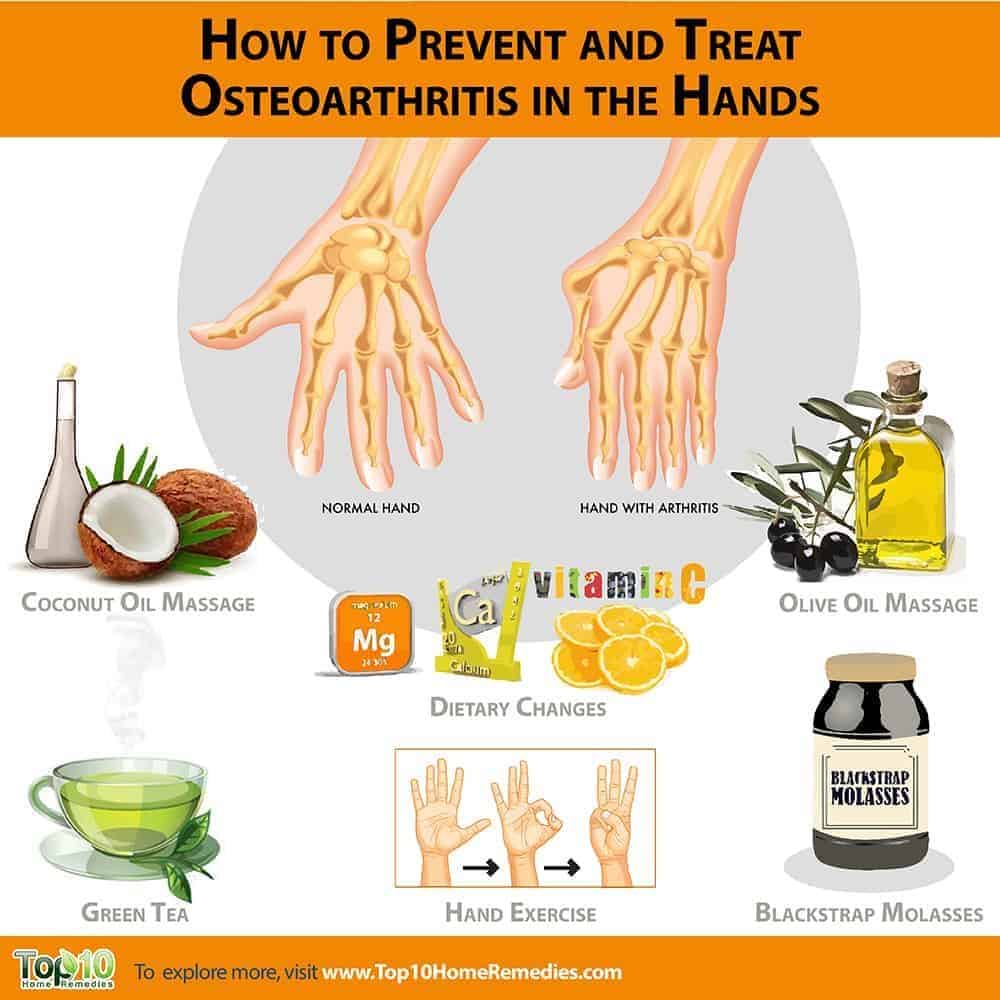 how to prevent and treat hand osteoarthritis in hands