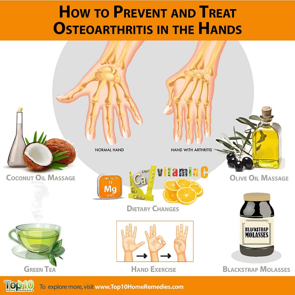 How to Prevent and Treat Osteoarthritis in the Hands