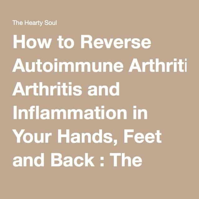 How to Reverse Autoimmune Arthritis and Inflammation in Your Hands ...