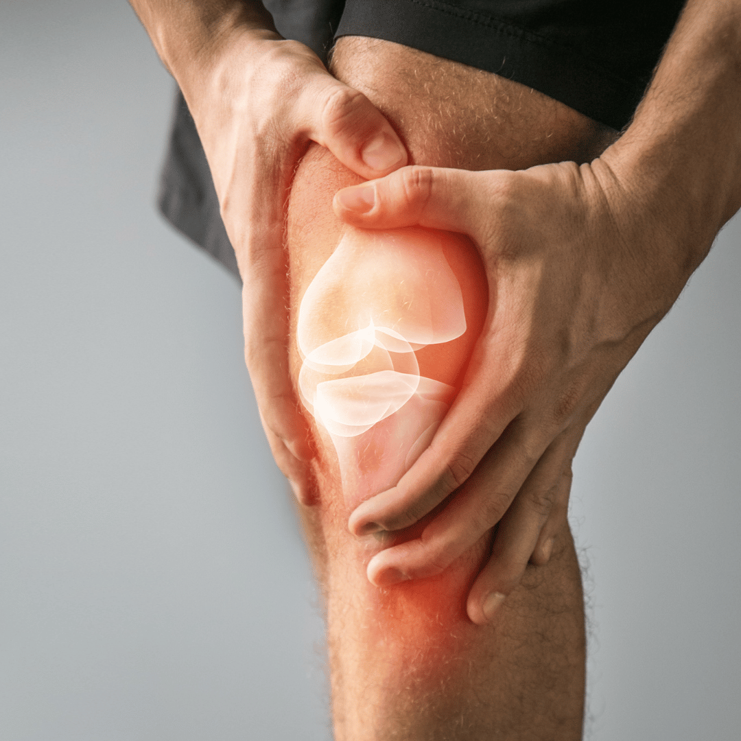 How To Stop Arthritis Pain In Knee