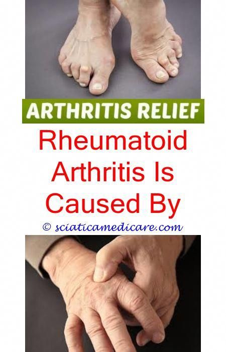 How to tell if you have arthritis in your feet.Sacroiliac ...