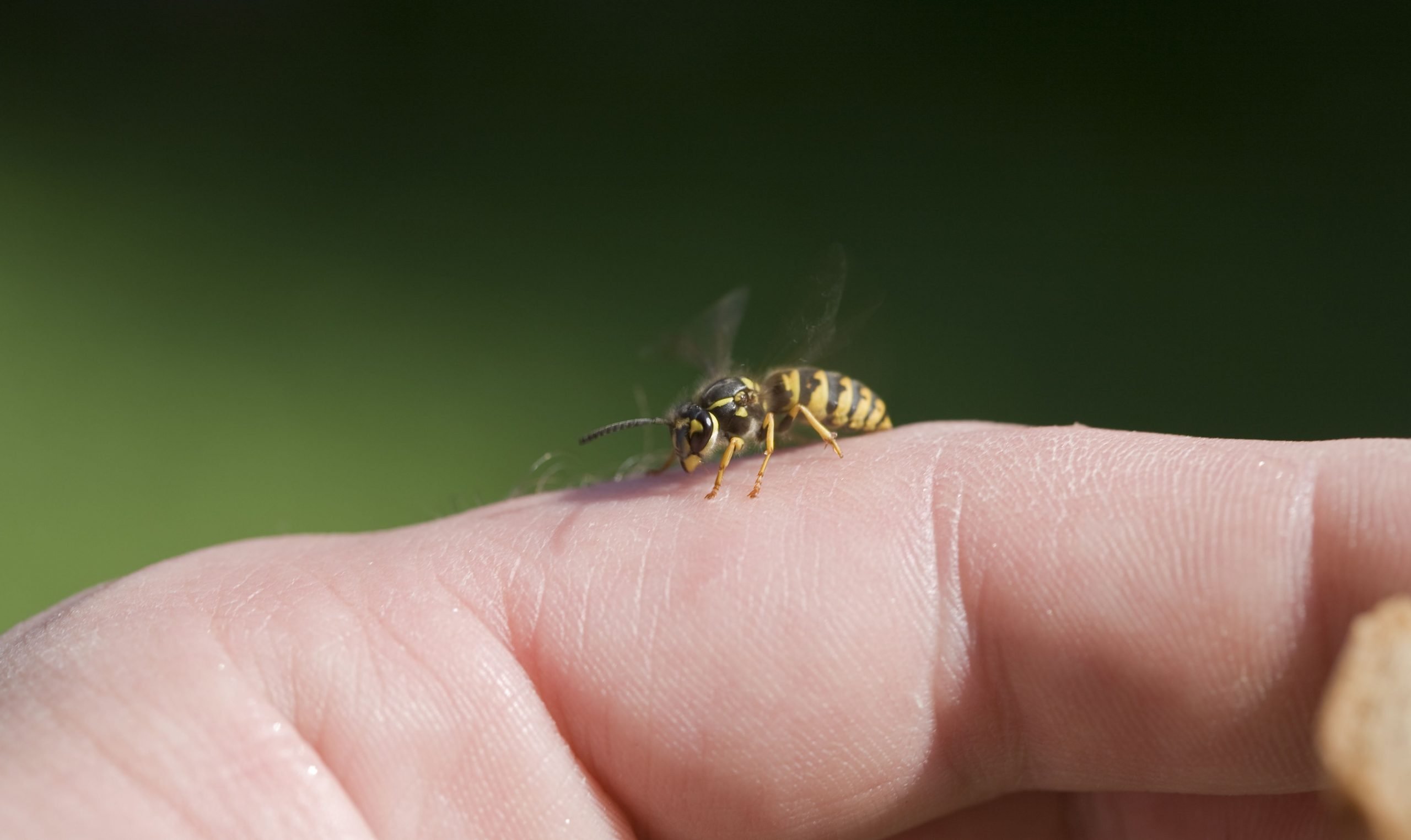 How to Treat a Bee Sting Safely