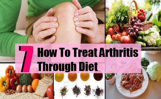 How To Treat Arthritis Through Diet