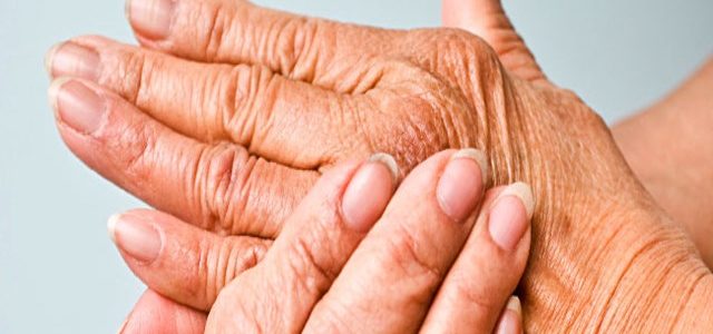 How To Treat Pain From Psoriatic Arthritis