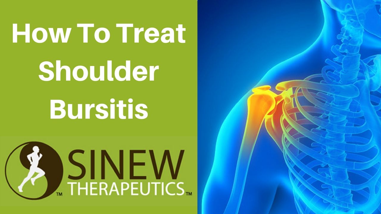 How to treat shoulder bursitis and speed recovery using ...