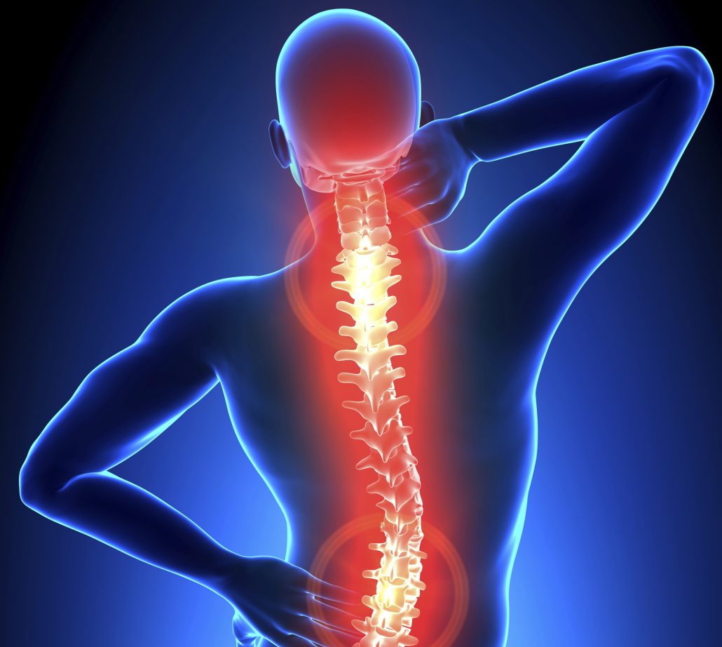 Is Osteoarthritis Causing Your Neck or Back Pain?
