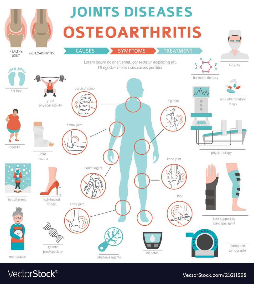Joints diseases arthritis osteoarthritis symptoms Vector Image