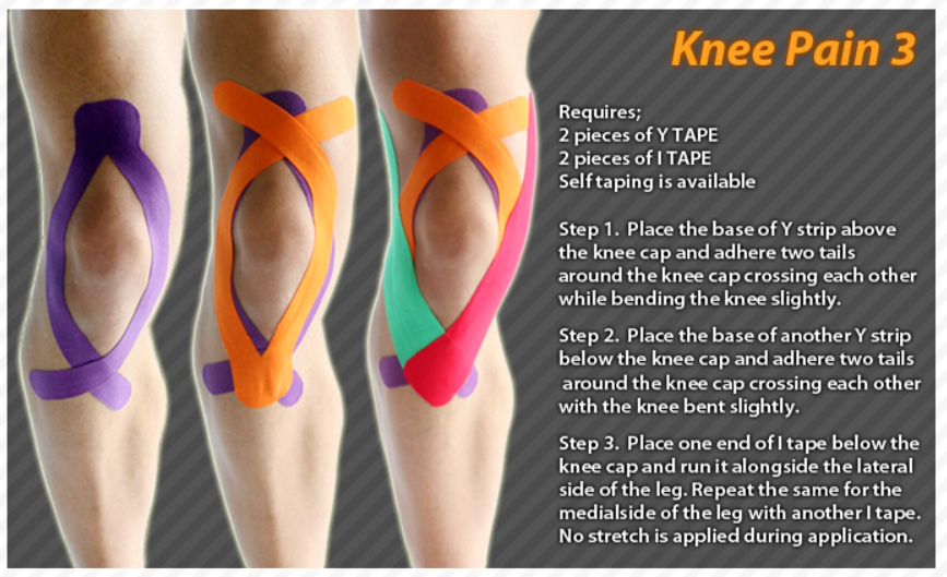 Kinesiology taping instructions for knee pain #ktape #knee ...