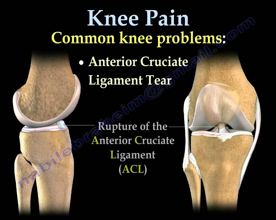 Knee Pain , common causes