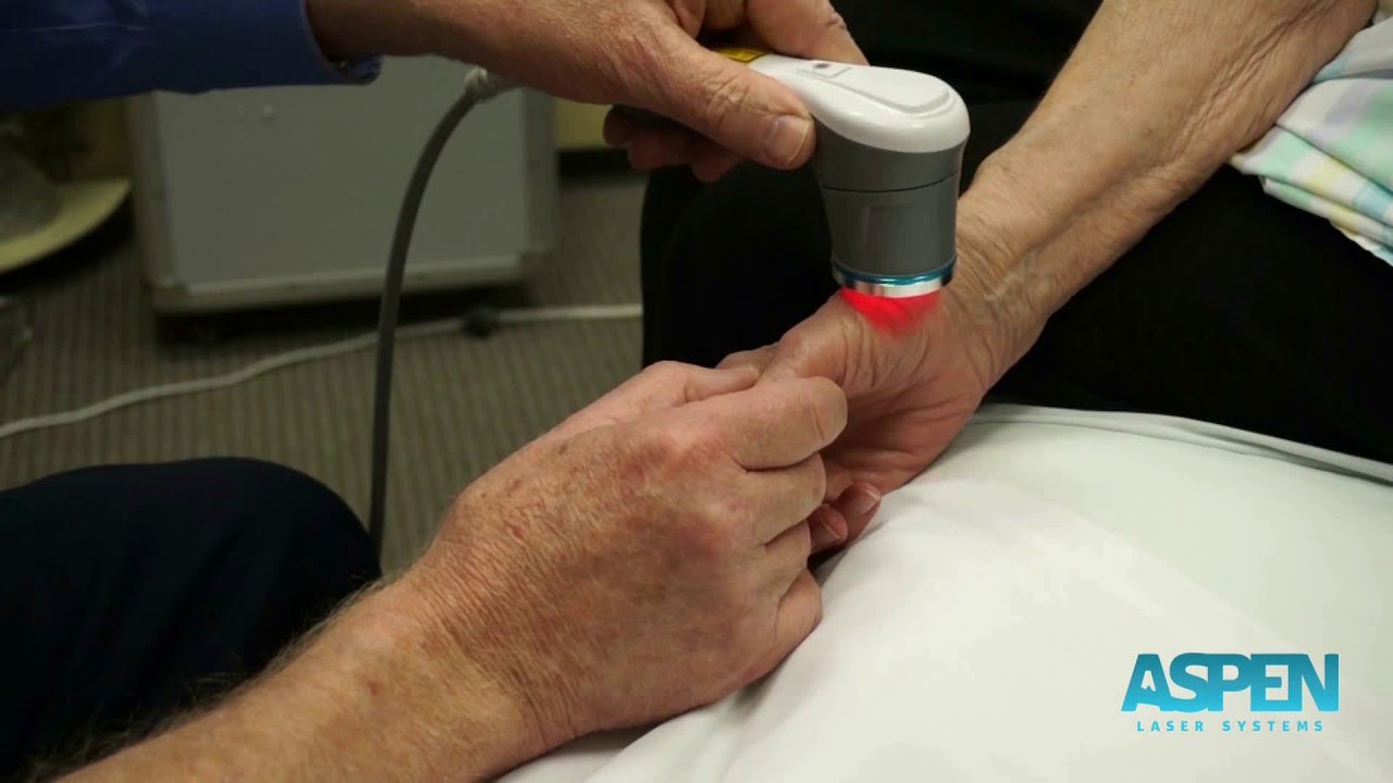 Laser Therapy Treatment for Thumb Arthritis Carpal Tunnel with Class IV ...