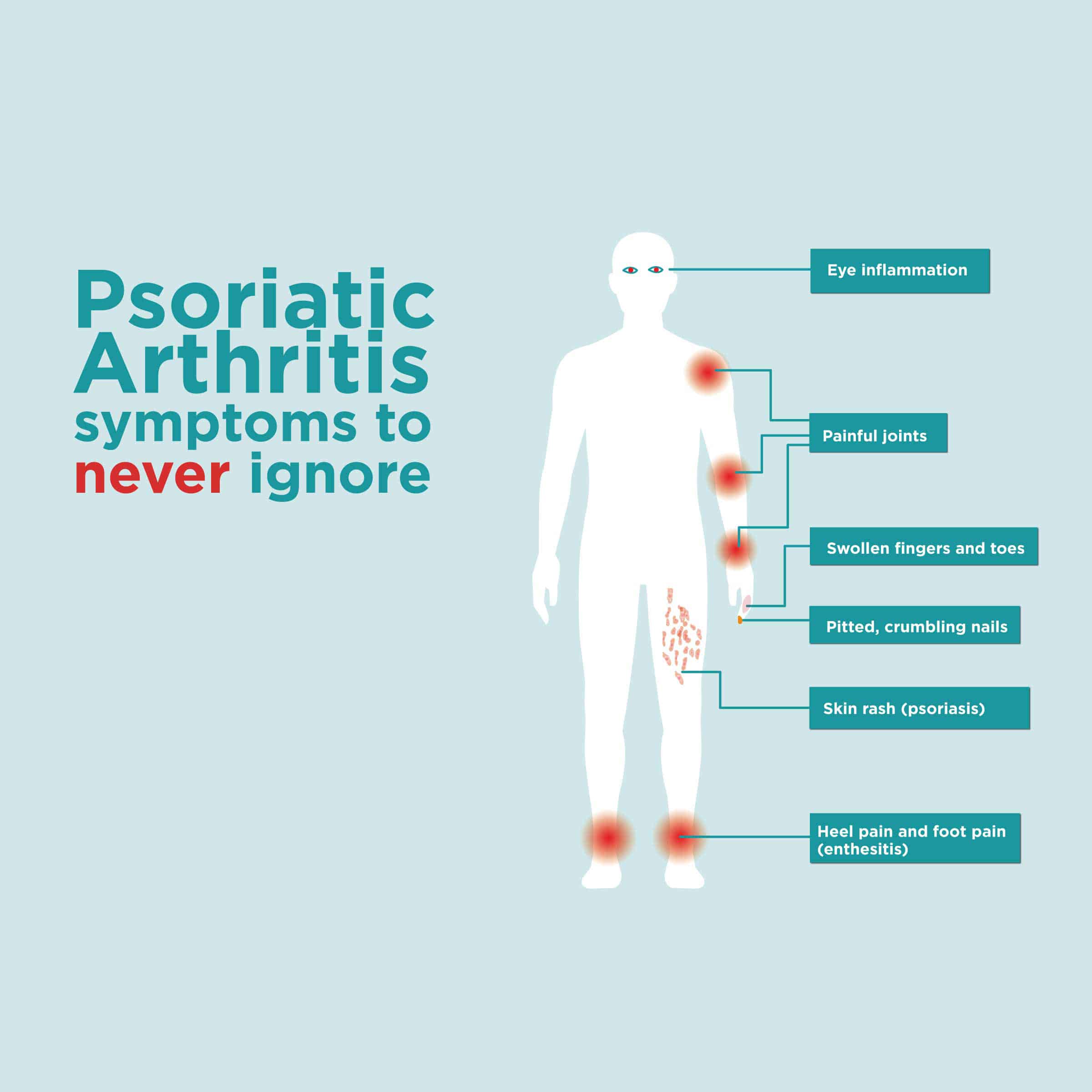 Learning About Psoriatic Arthritis (PsA)
