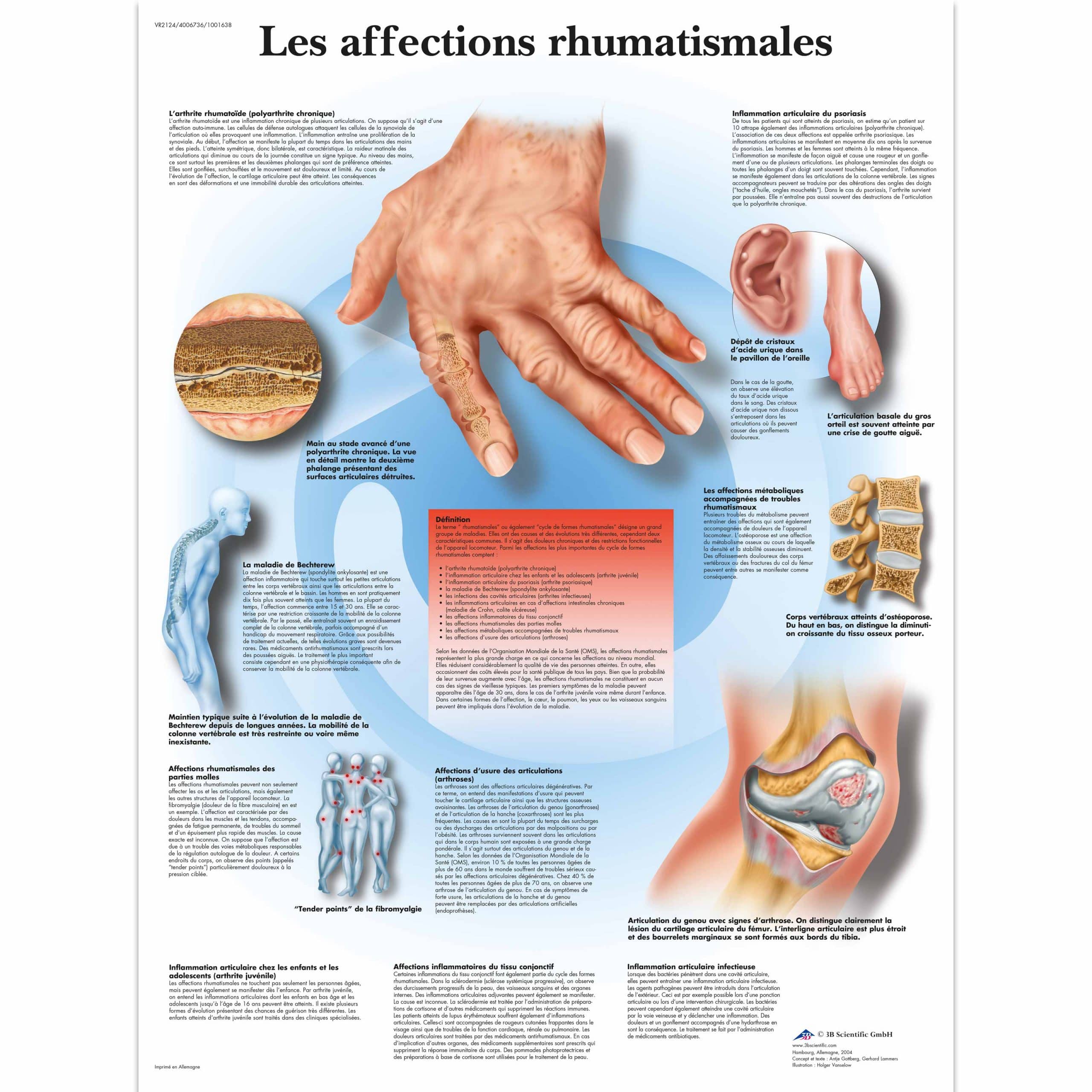 Les affections rhumatismales