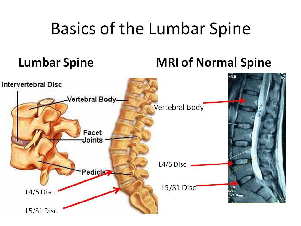 lower back pain Archives