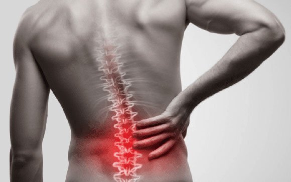 Lower Back Pain Due To Spinal Arthritis Non