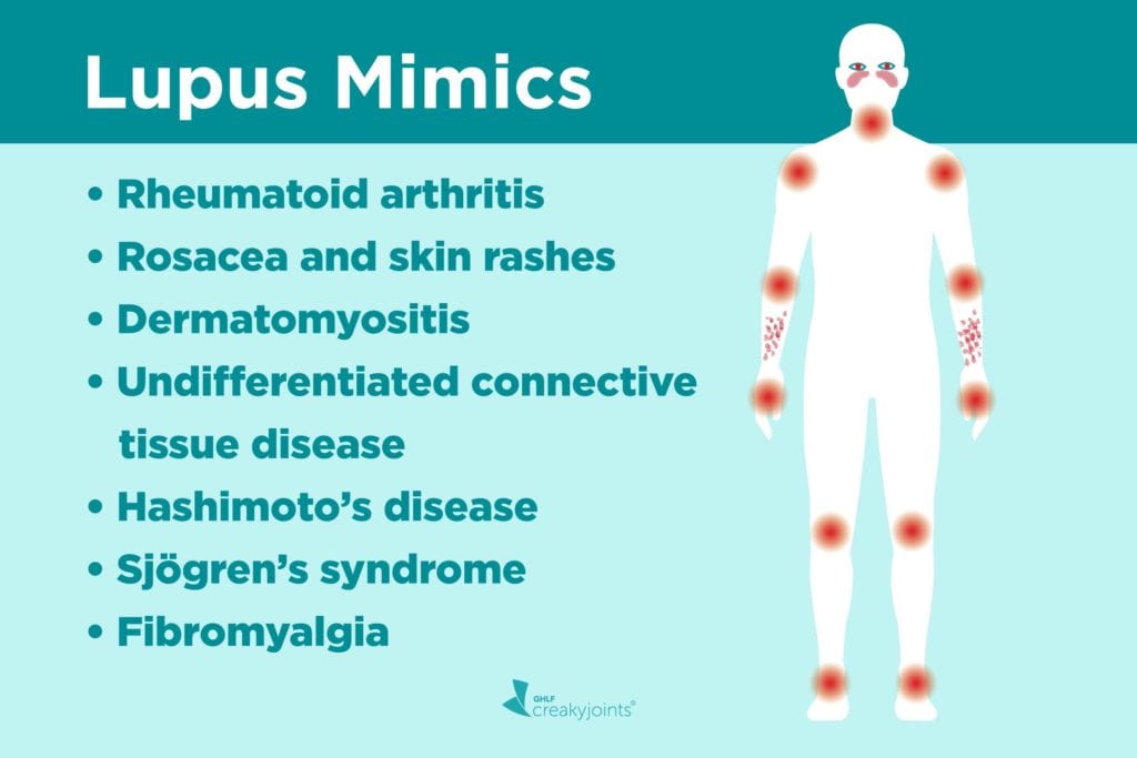 Lupus Misdiagnosis: Diseases That Can Mimic Lupus