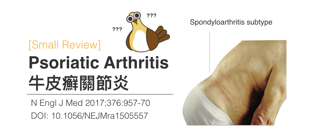 Methotrexate reviews for psoriatic arthritis