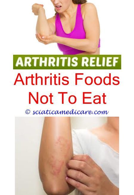 Natural Remedies for Arthritis For A Safer Alternative ...