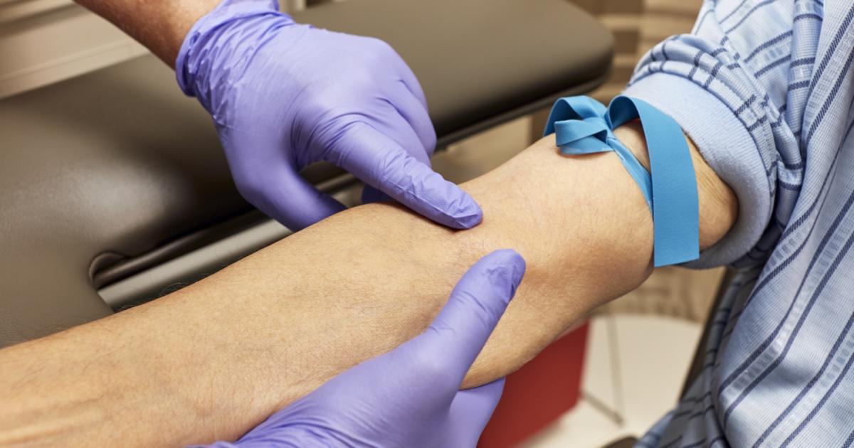 nstaylordesign: Does Rheumatoid Arthritis Show Up In A Blood Test