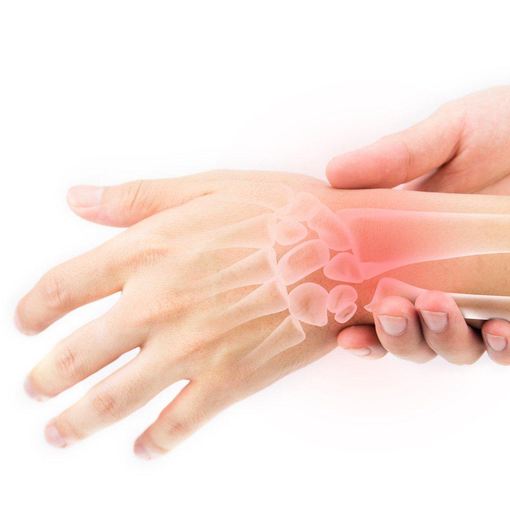 Osteoarthritis of Hand