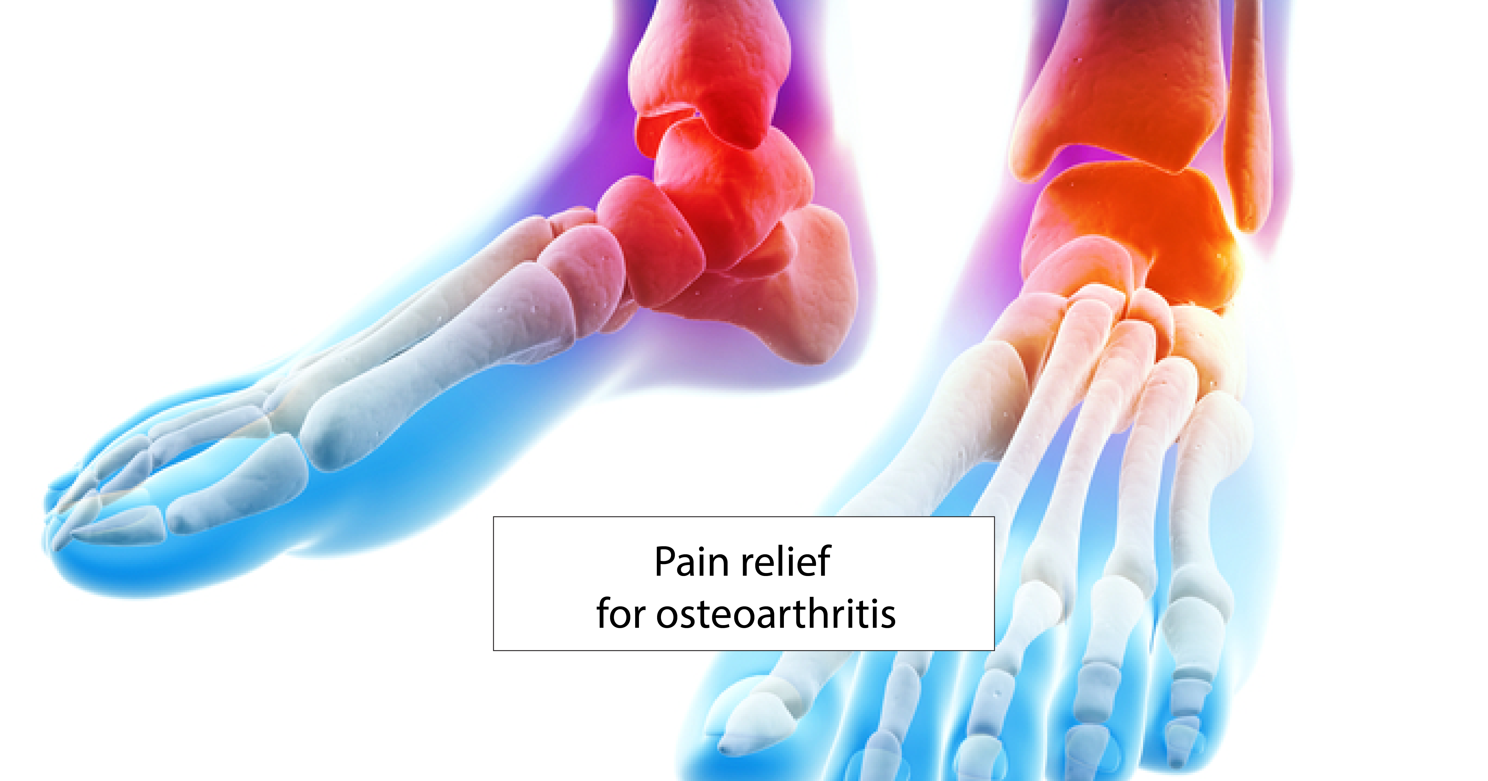 Pain relief for osteoarthritis: everything you need to know!