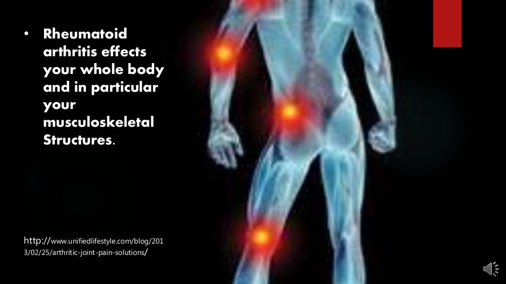 Physiological Effects Of Rheumatoid Arthritis
