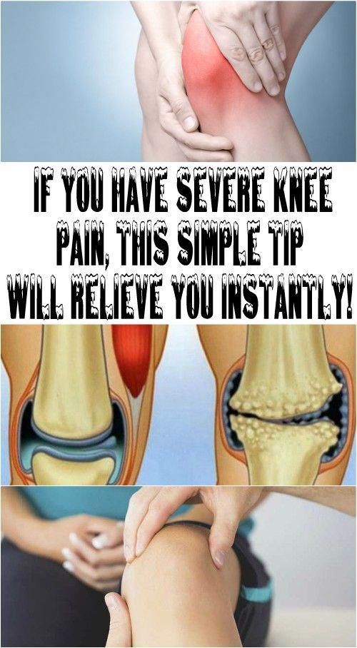 Pin on knee pain causes natural treatments