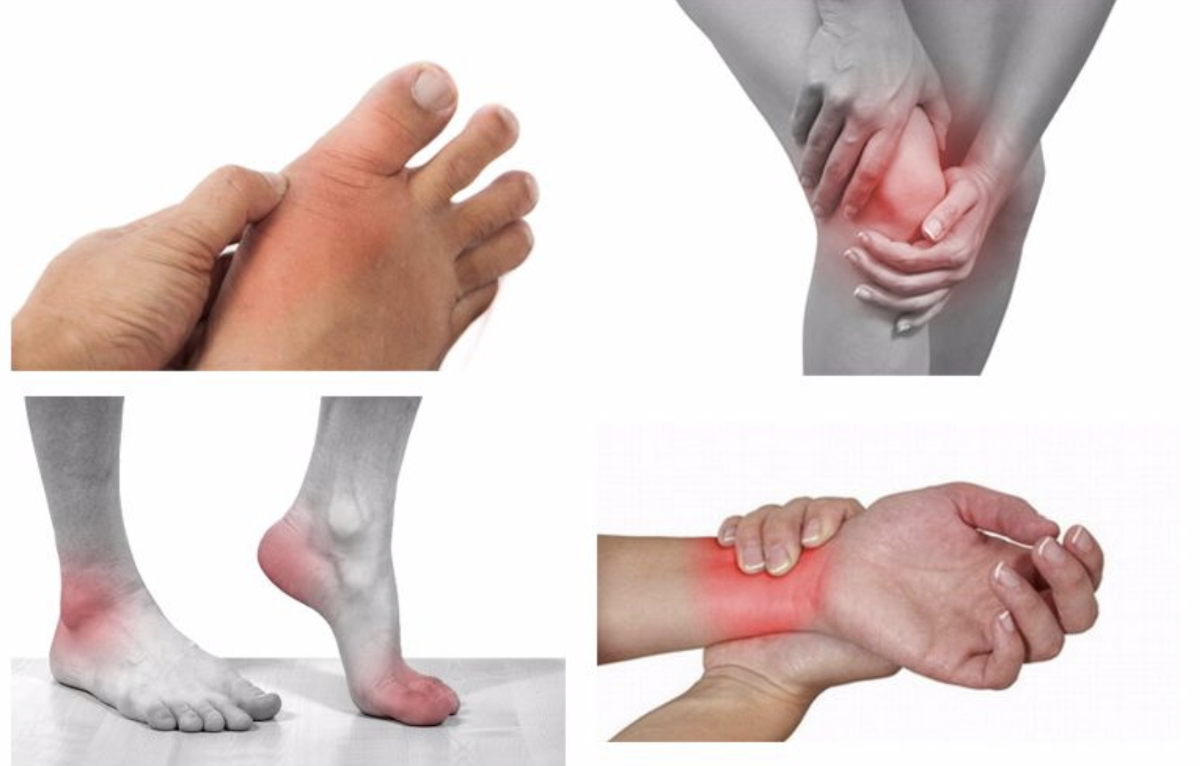 Prevent Gout, Joint Pain and Remove Uric Acid Crystallization From Your ...