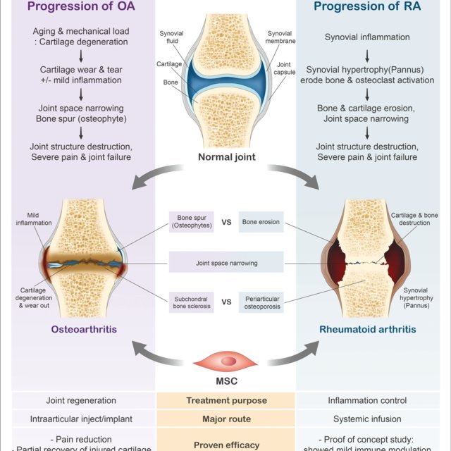 progression of rheumatoid arthritis ra and