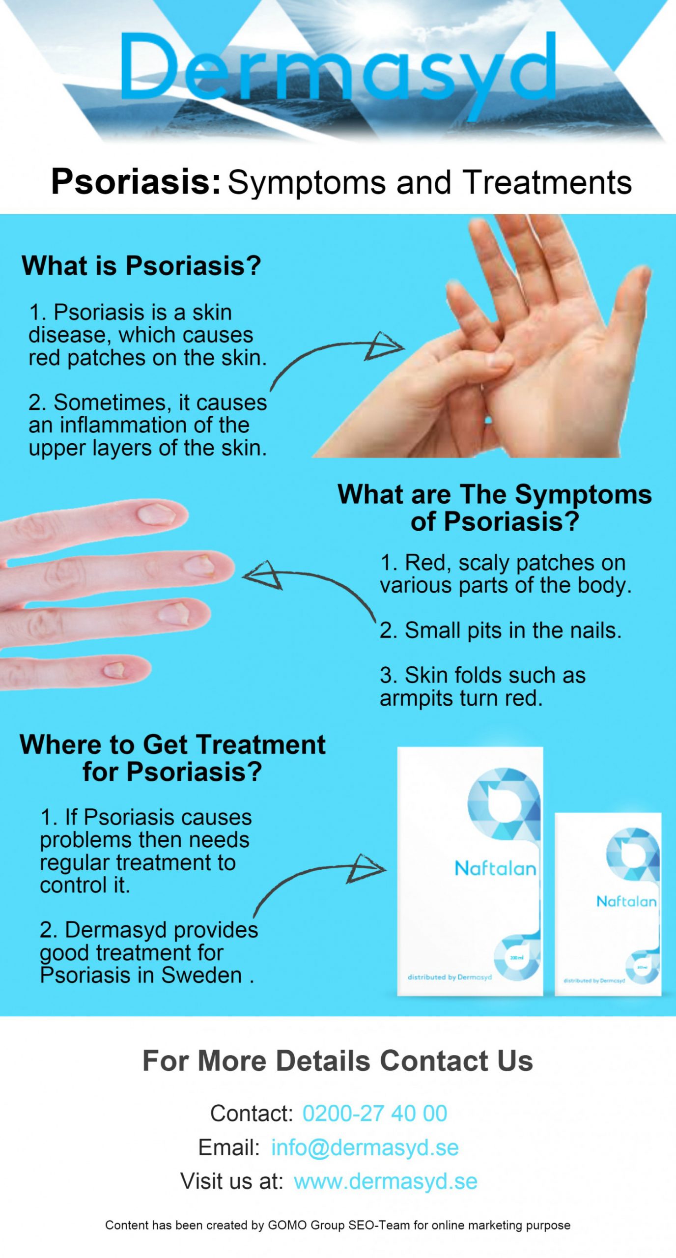 Psoriasis: Symptoms and Treatment