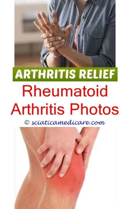 psoriatic arthritis can gout cause rheumatoid arthritis ...
