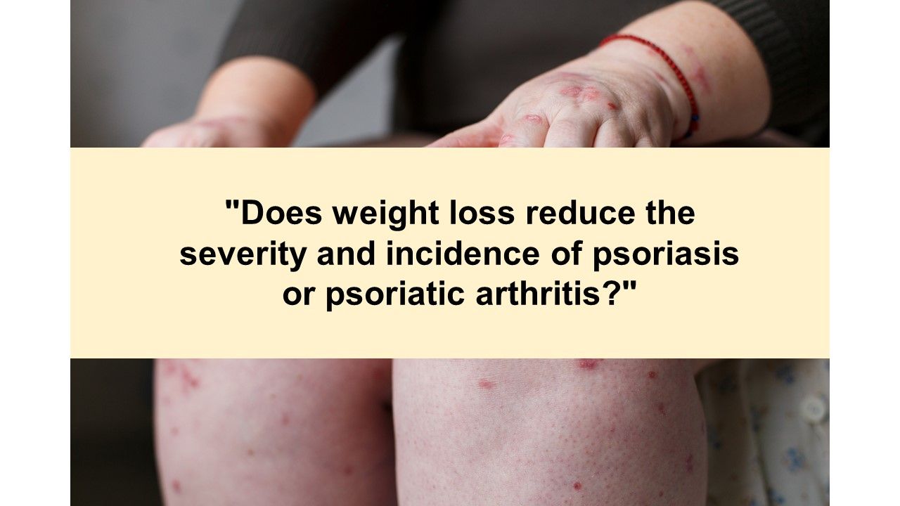 Psoriatic Arthritis Health Quiz: Is it axial PsA or AS ...