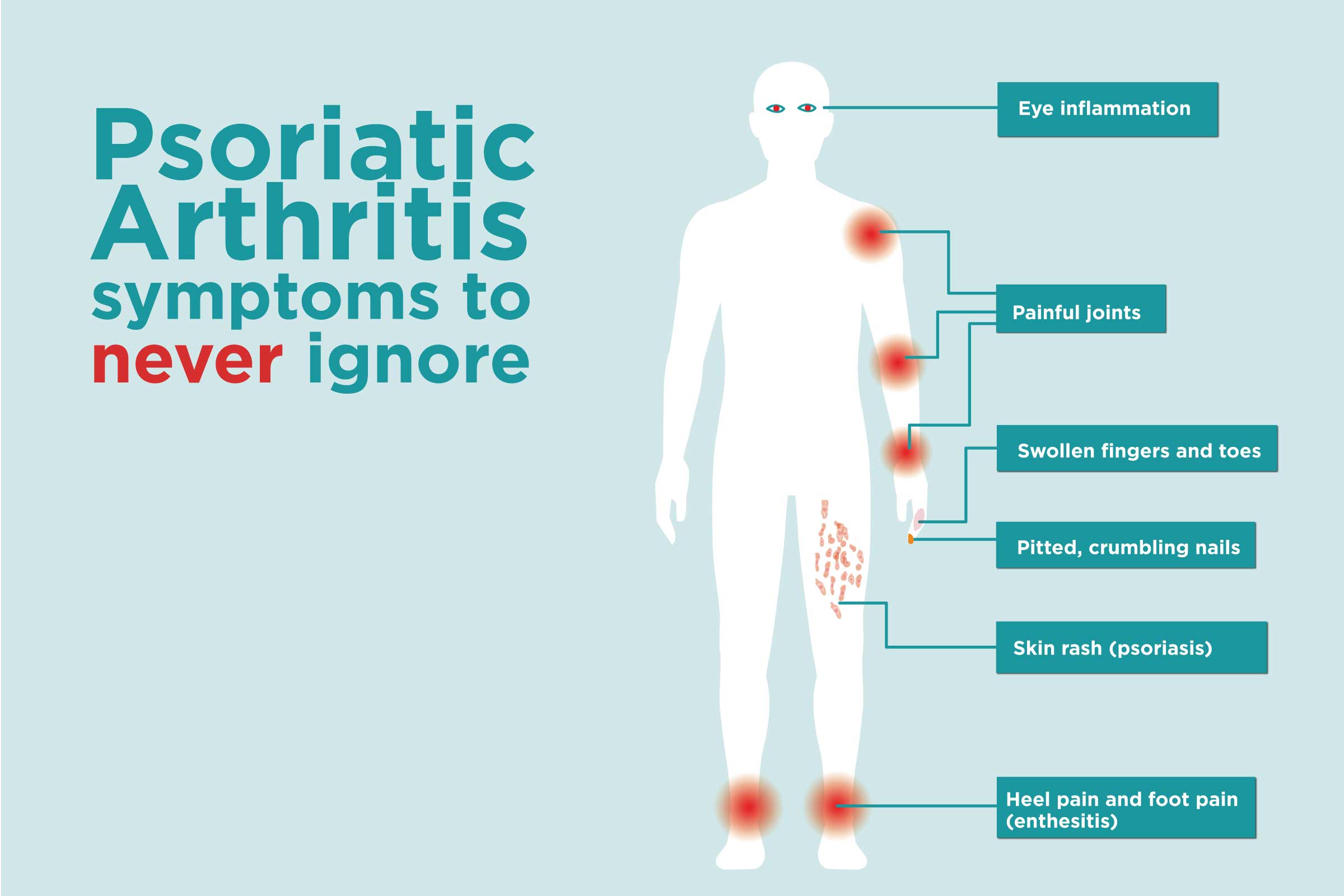 Psoriatic Arthritis Signs and Symptoms