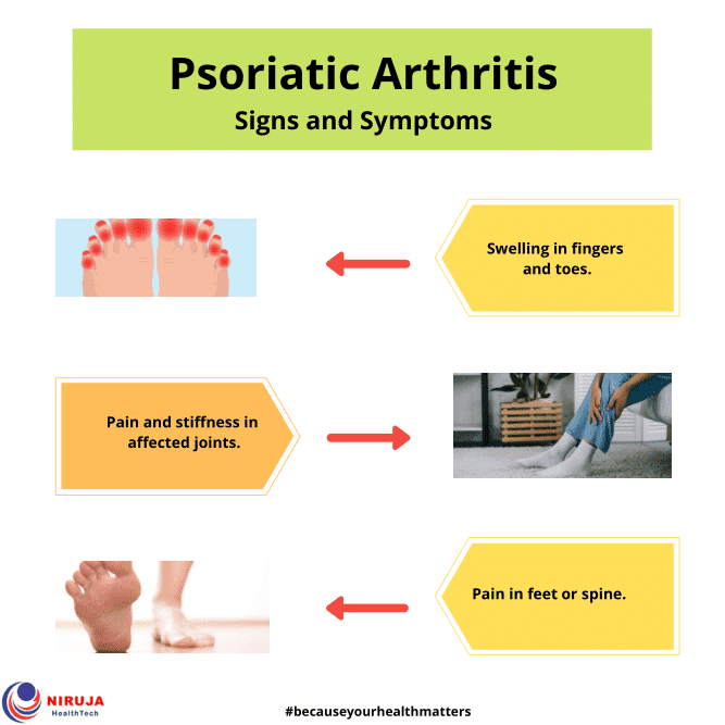 psoriatic arthritis signs symptoms niruja healthtech