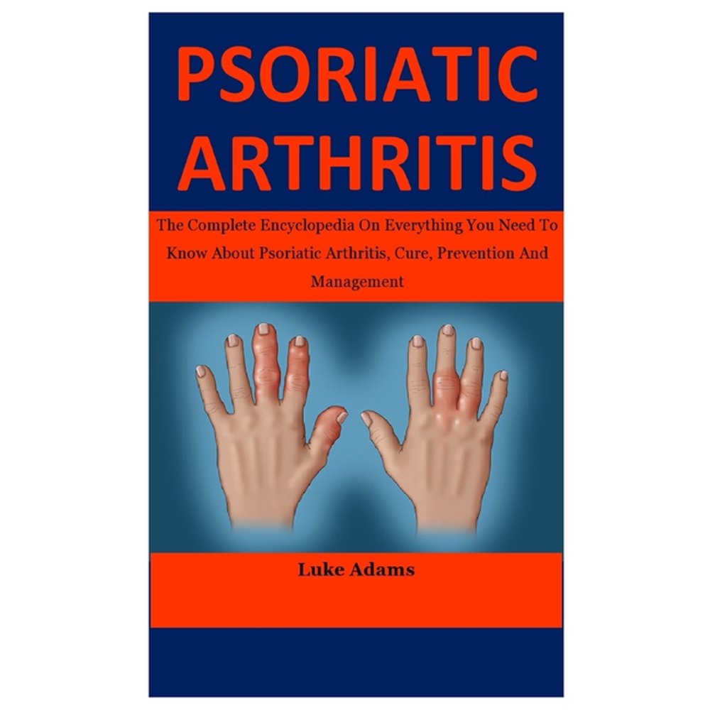 Psoriatic Arthritis : The Complete Encyclopedia On Everything You Need ...