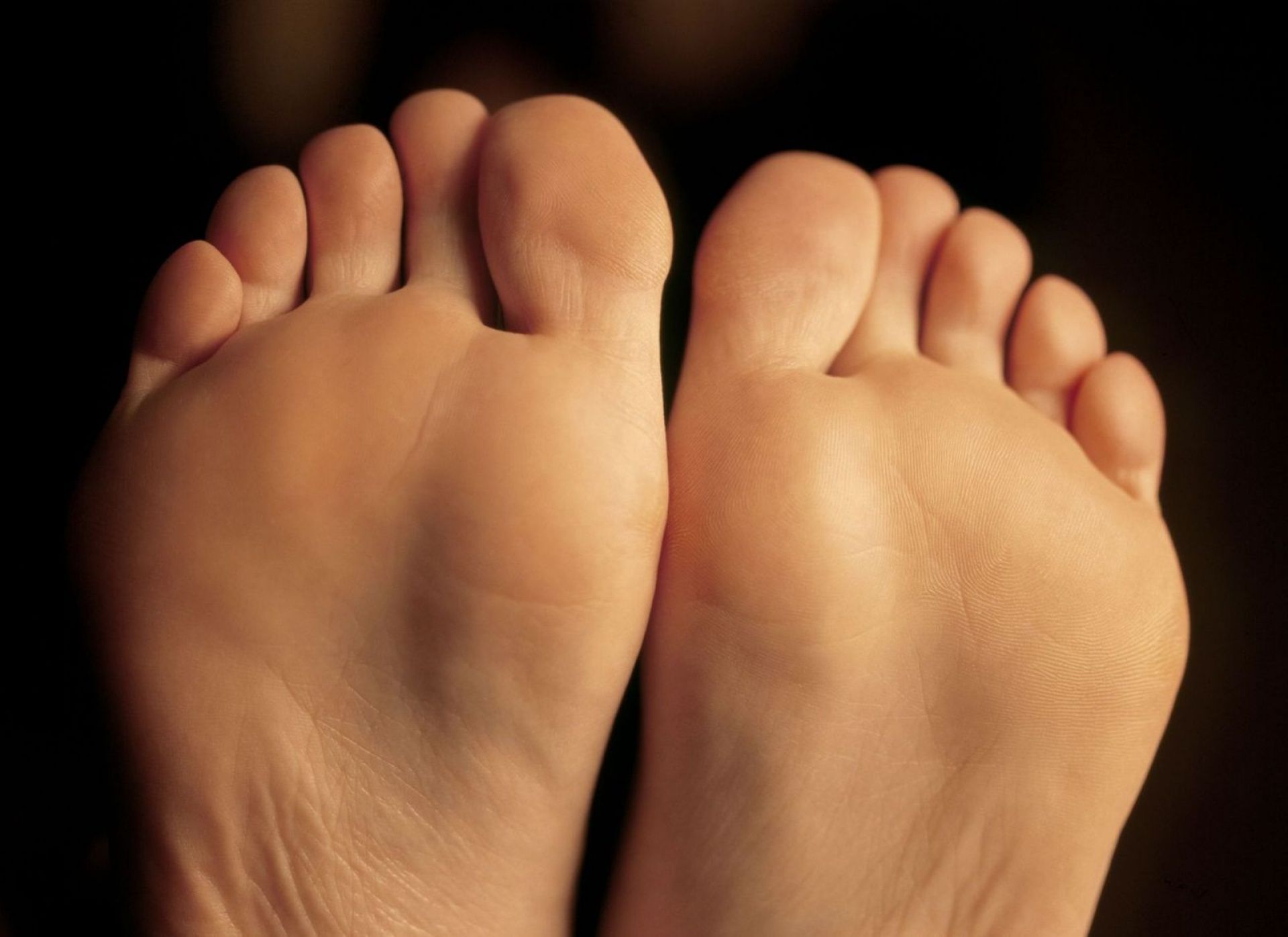 Psoriatic Arthritis Toes