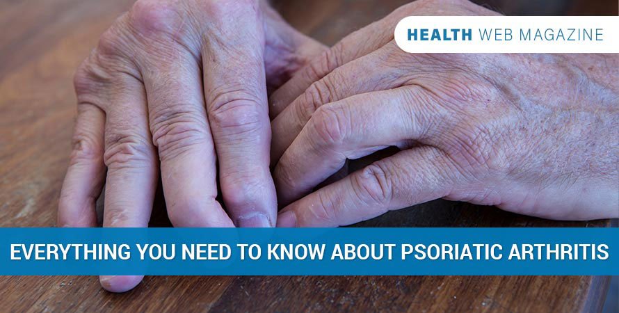 Psoriatic Arthritis: Types, Symptoms, Diagnosis, and More