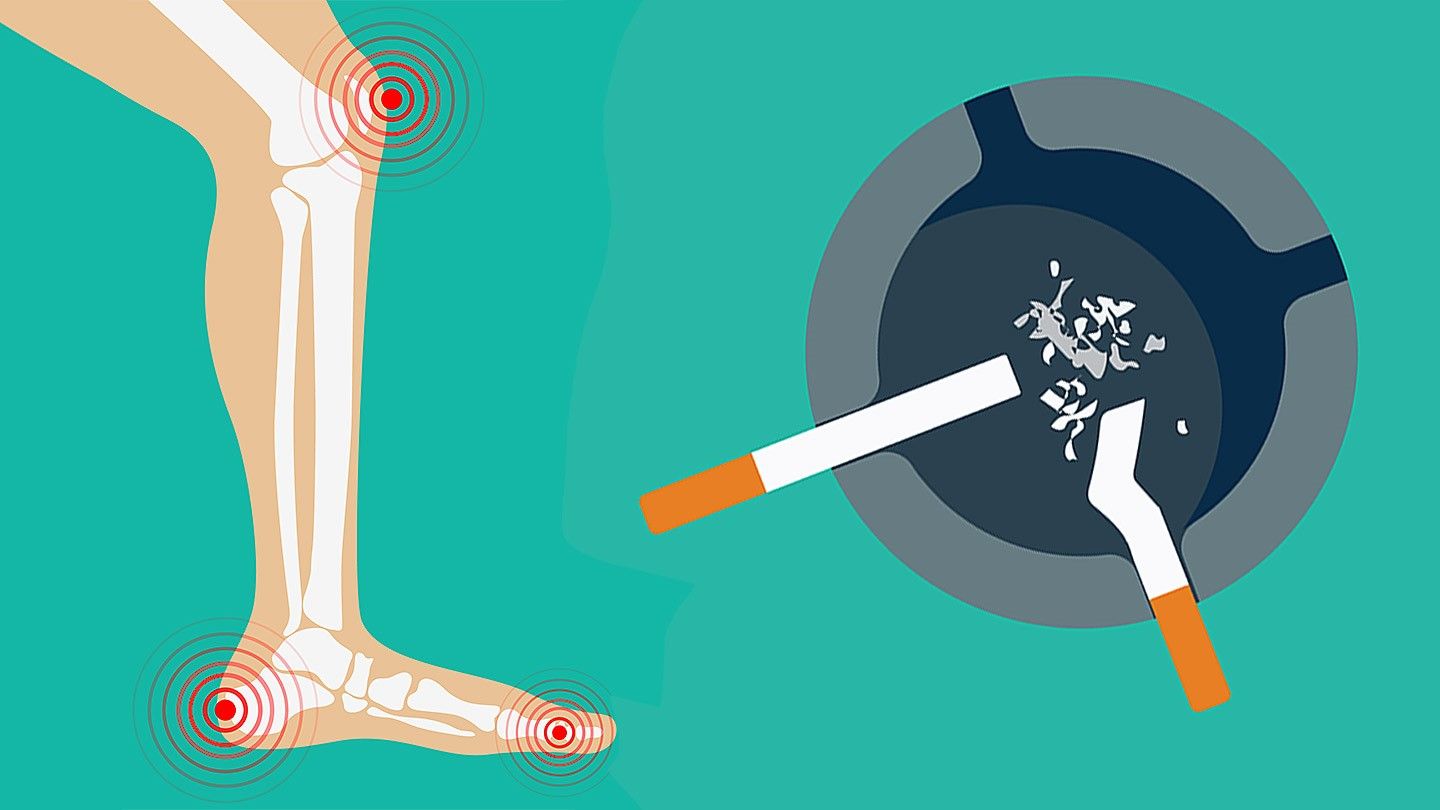Quit Smoking to Improve Rheumatoid Arthritis Symptoms ...
