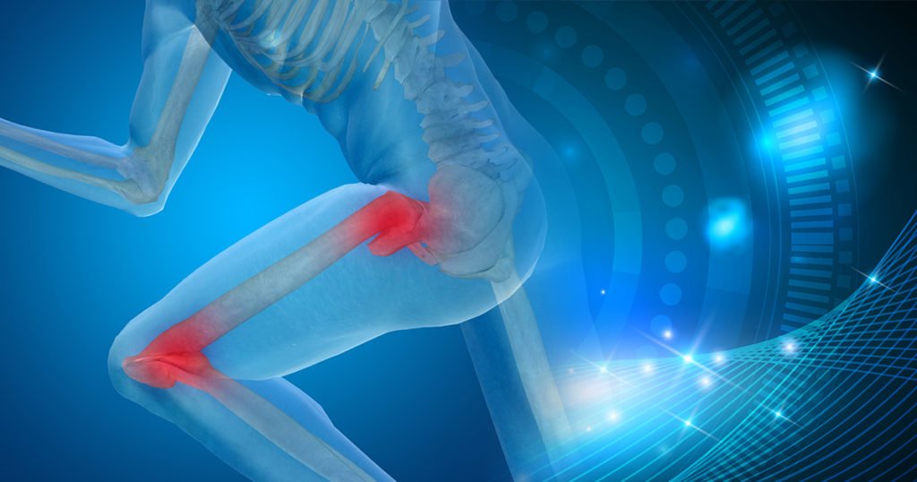 Regenerative Treatment Options for Arthritis of the Hip and Knee ...
