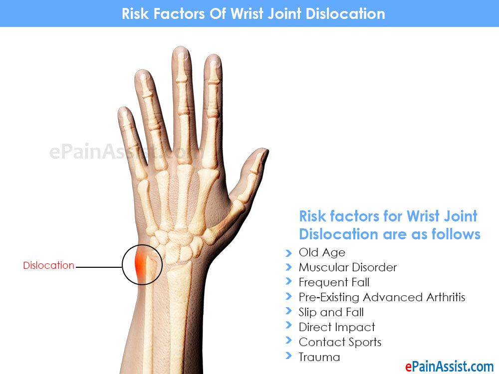 what-causes-arthritis-in-wrist-arthritisdaily