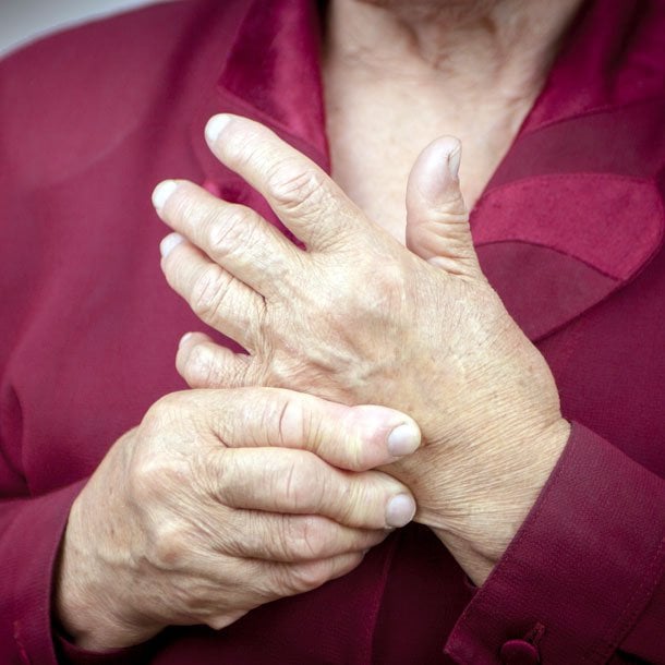 Rheumatoid Arthritis: COVID