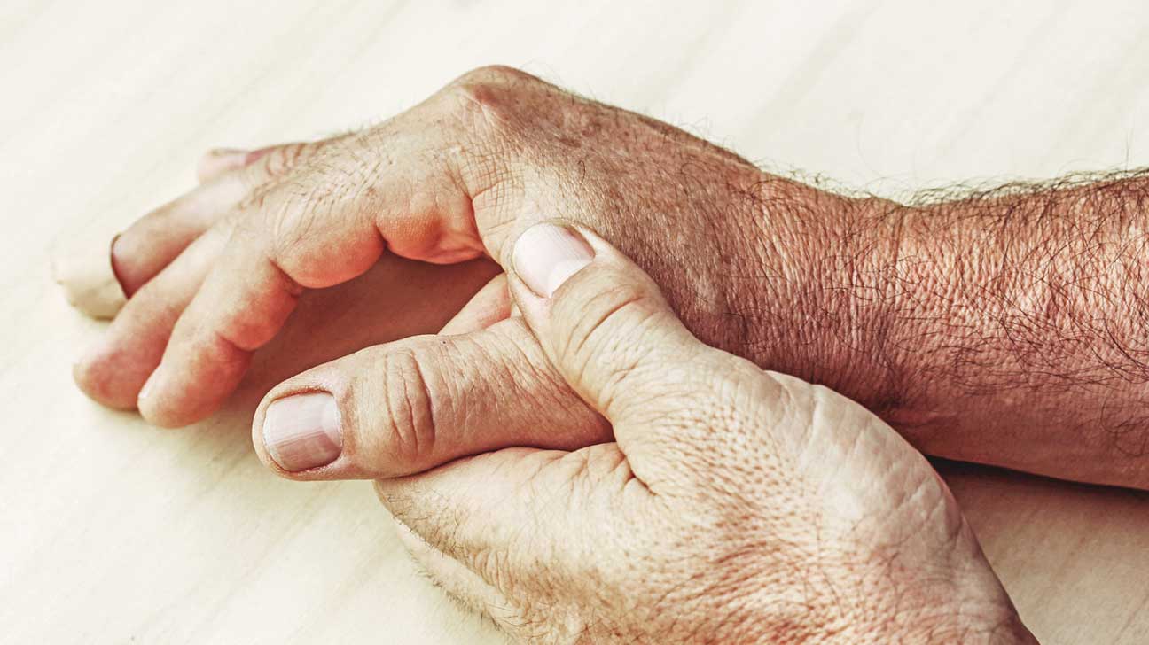 Rheumatoid Arthritis Deaths Declining
