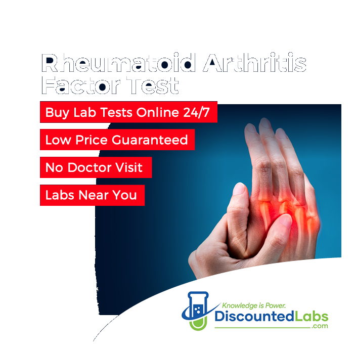 Rheumatoid Arthritis Factor Test