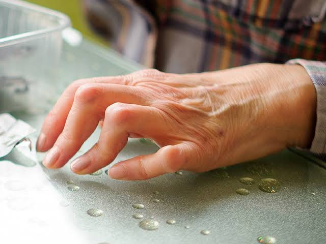 Rheumatoid Arthritis in the Elderly: Sufferers likely to ...