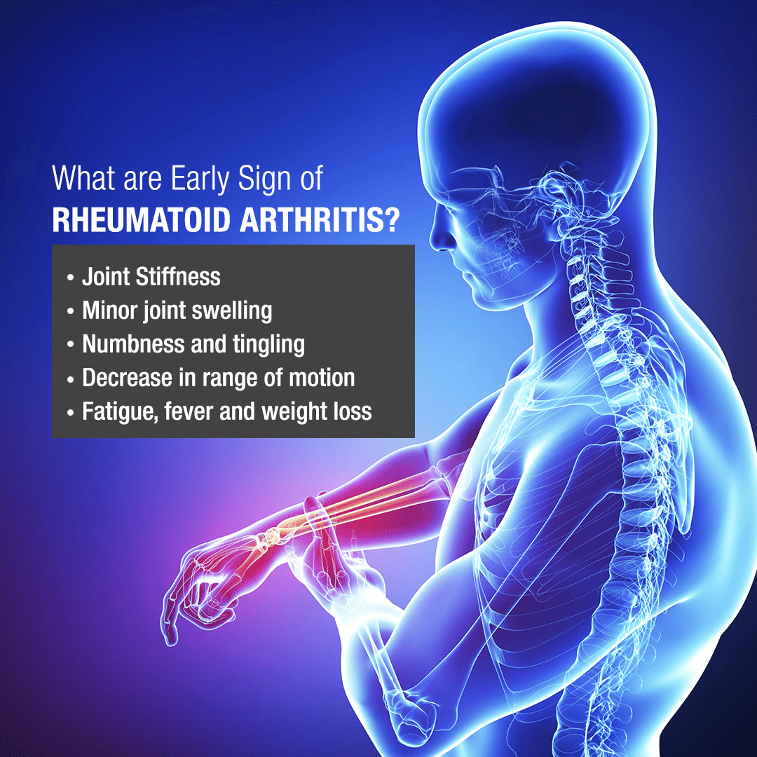 Rheumatoid arthritis is the second most common form of Arthritis. It is ...