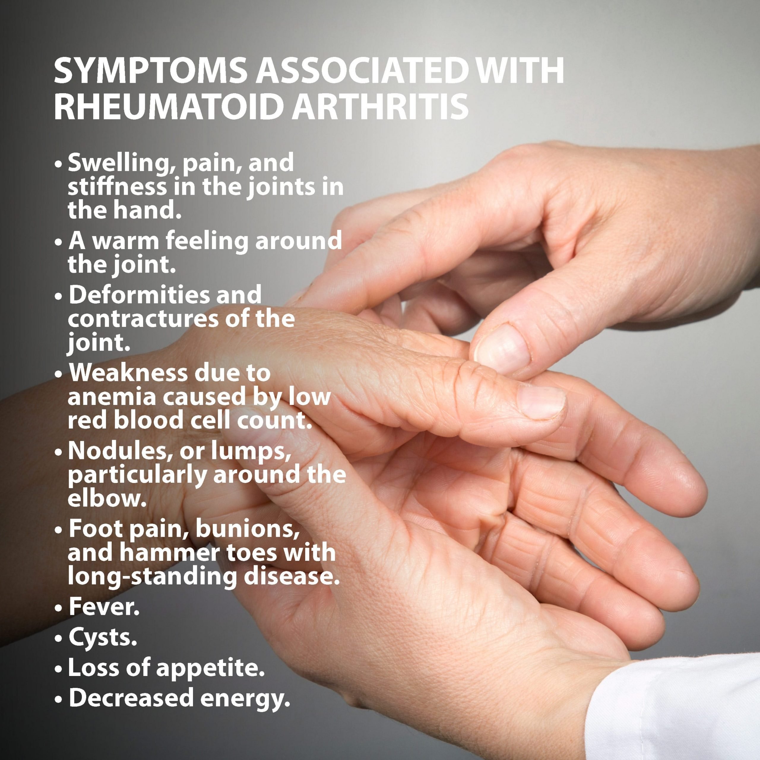 Rheumatoid Arthritis Of The Hand
