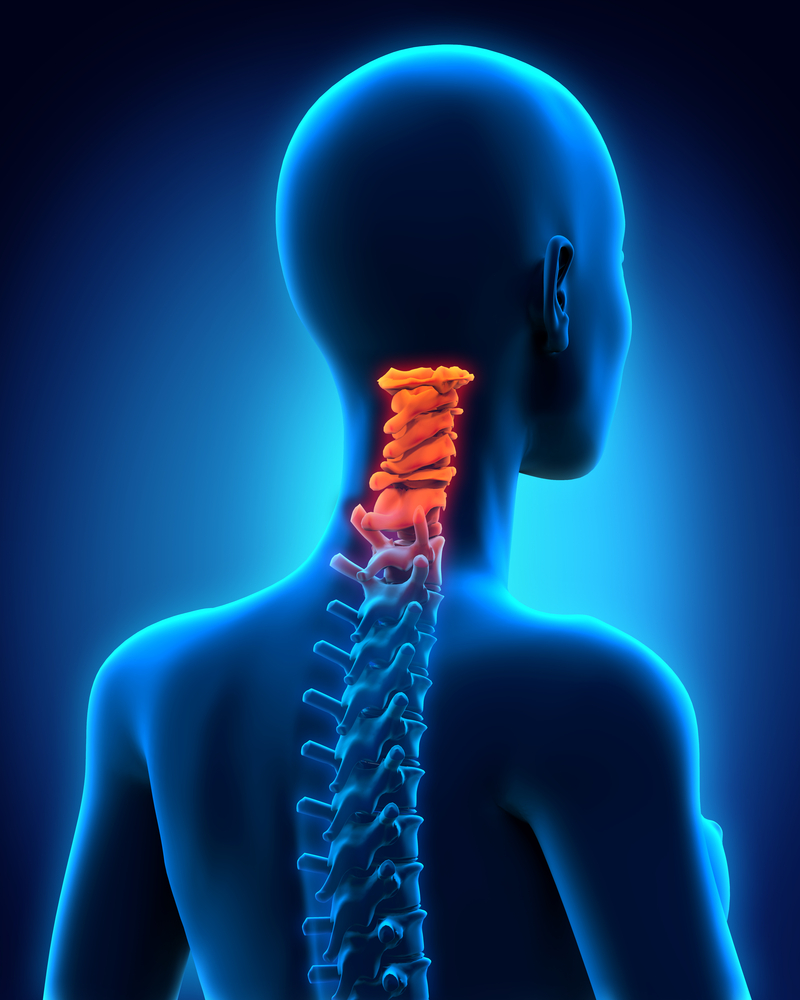 Rheumatoid Arthritis Patients Are Still Affected by with Cervical Spine ...