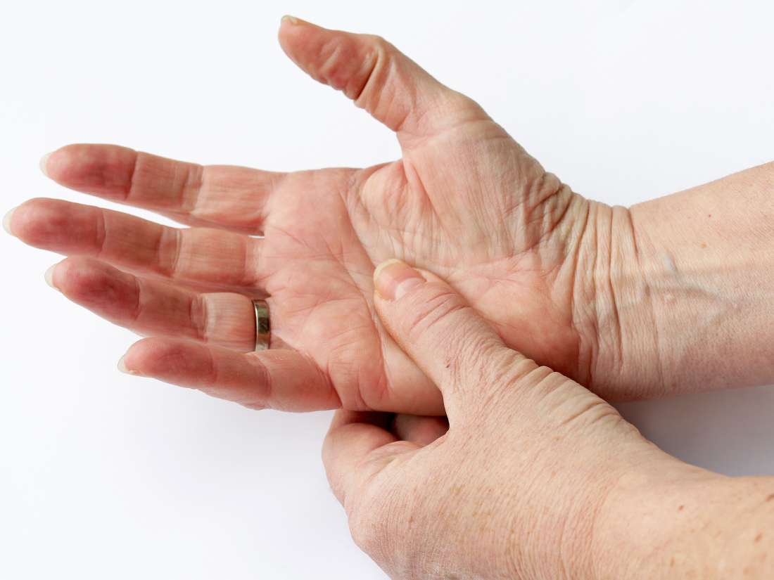 Rheumatoid arthritis (RA): Signs and symptoms